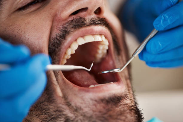 Best Dental Fillings (Composite and Amalgam)  in Granbury, TX